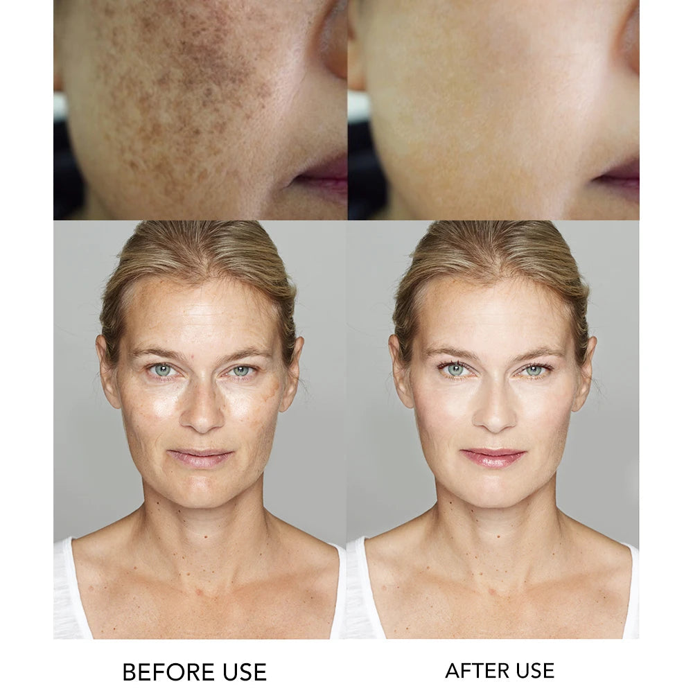 Whitening and Moisturizing Facial Cream, Naturally Brightens Skin Tone, Eliminates Dark Spots, With Nicotinamide Spf35+ exovai.com