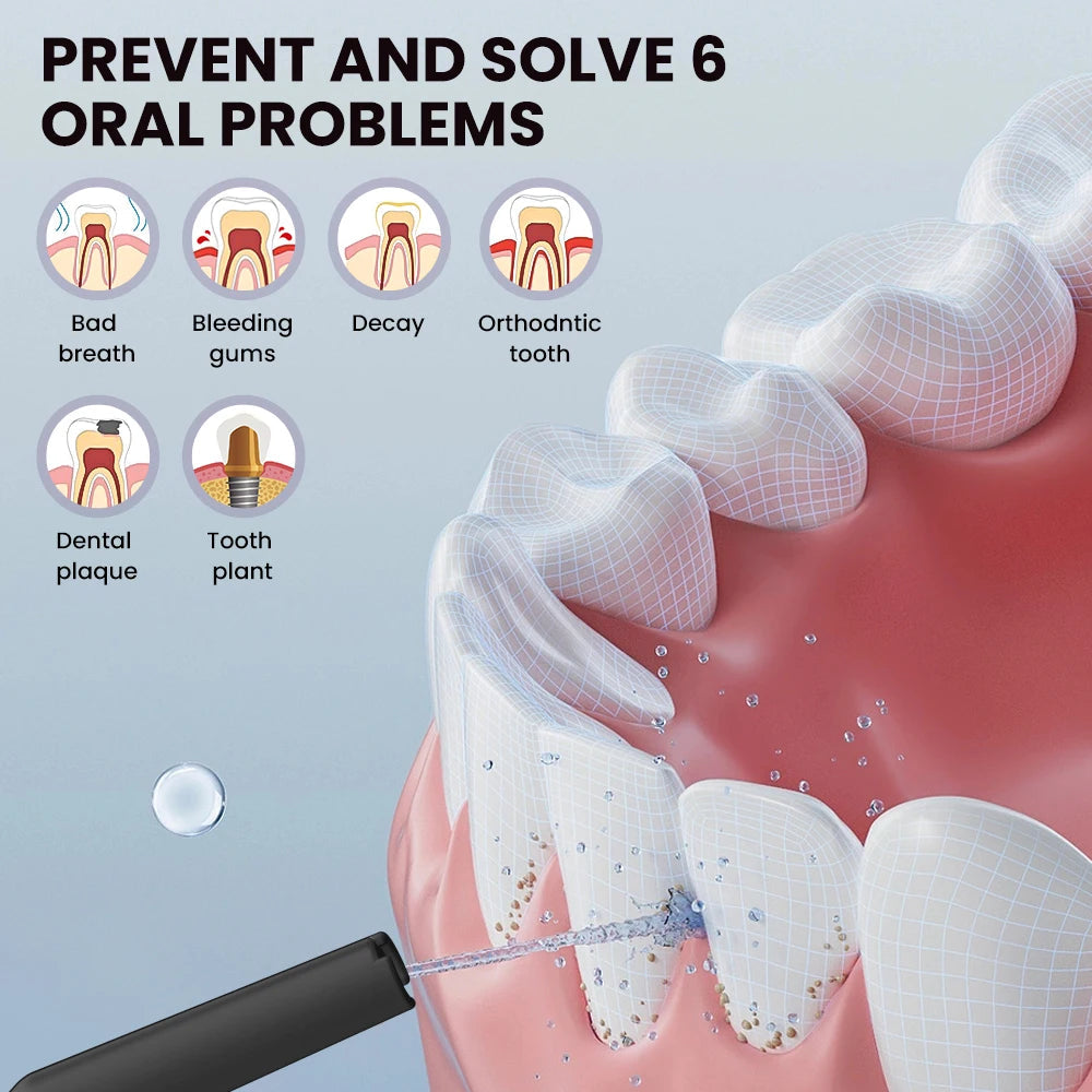 Sejoy Water Dental Flosser Oral Irrigator 8 Jet Tips 5 Modes IPX7 Waterproof  Portable Cordless Teeth Cleaner for Home&Travel exovai.com